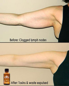 Lymphatic Ginger Oil