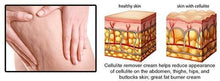 Load image into Gallery viewer, Cellulite Removal Cream