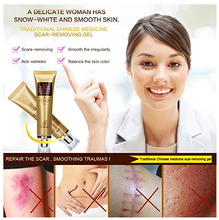 Load image into Gallery viewer, Scar and Acne Removal Cream