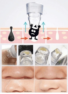 BLACKHEAD SUCTION TOOL